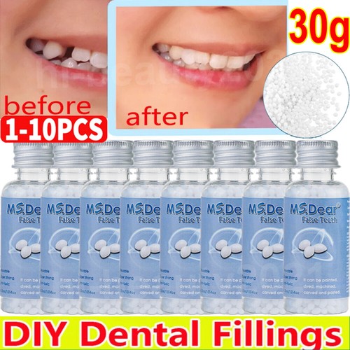 Temporary tooth repair - repair, kit