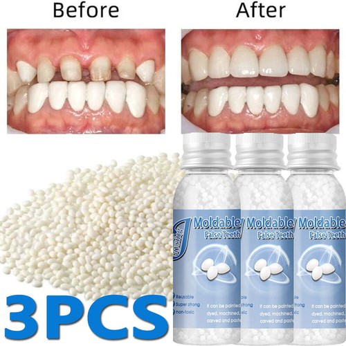 Tooth repair kit for - repair, broken