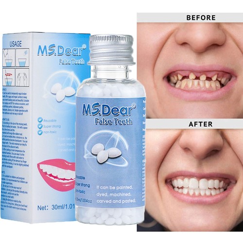 Tooth repair kit - tooth, temporary