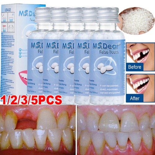 Teeth repair temporary fix kit - temporary,