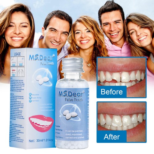 30ml temporary tooth - 30ml, repair