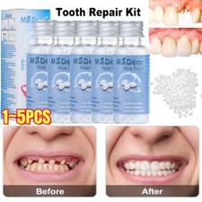 Temporary Tooth Repair Kit