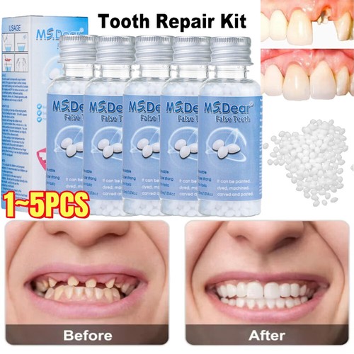 Temporary tooth repair - temporary,