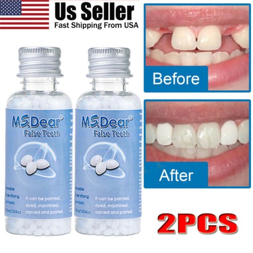 2pcs tooth repair kit - repair,