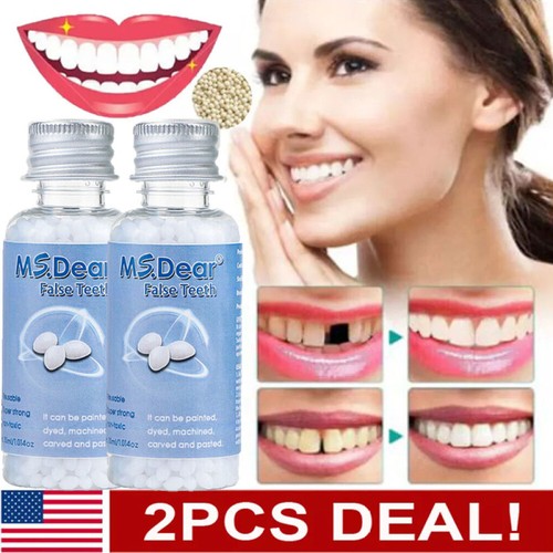 Tooth repair kit - kit,