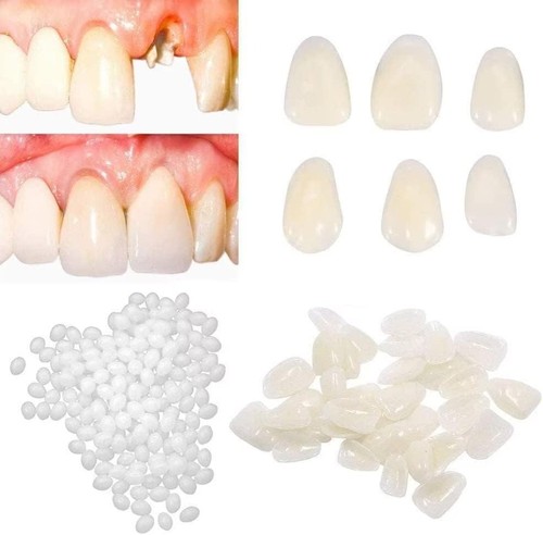 Fake tooth repair - fake,