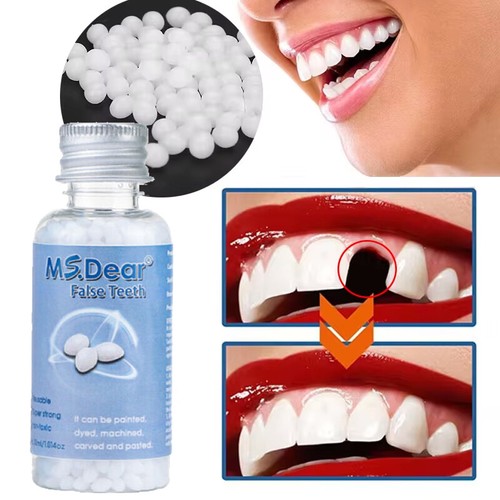 Tooth repair kit temporary - repair,