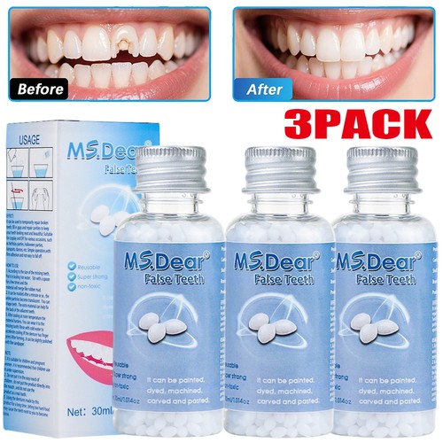 3pcs tooth repair - tooth,