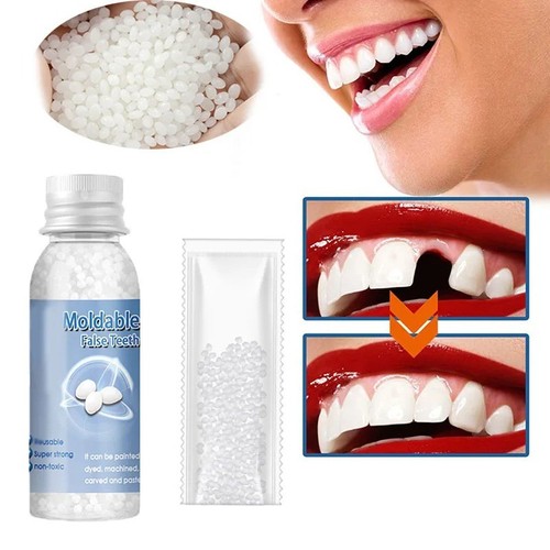 Tooth repair kit temporary - -,