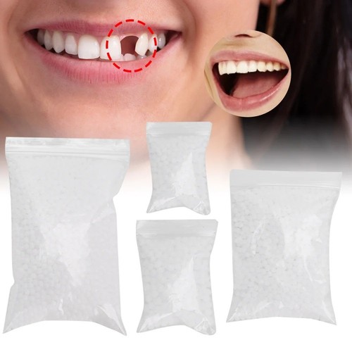 Temporary tooth repair beads - temporary,