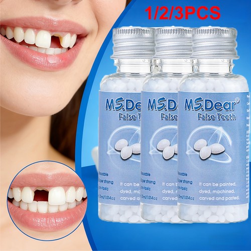 Tooth repair kit temporary - tooth,