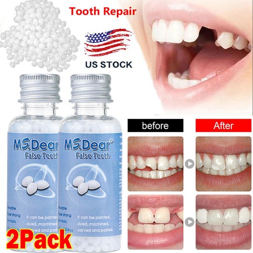 Tooth repair kit - tooth,