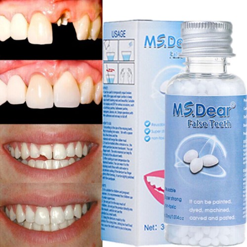 Teeth repair temporary fix - temporary,