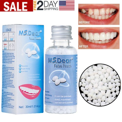 Temporary tooth repair kit - repair,