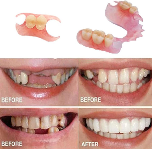 Yourself fake tooth - do,