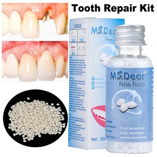 Temporary tooth repair kit - temporary,