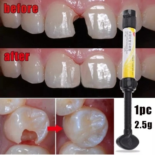 Dental cement teeth resin - dental,