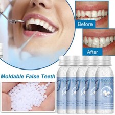 5/3x Tooth Repair Granules