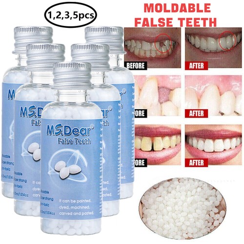 Tooth repair kit - tooth,