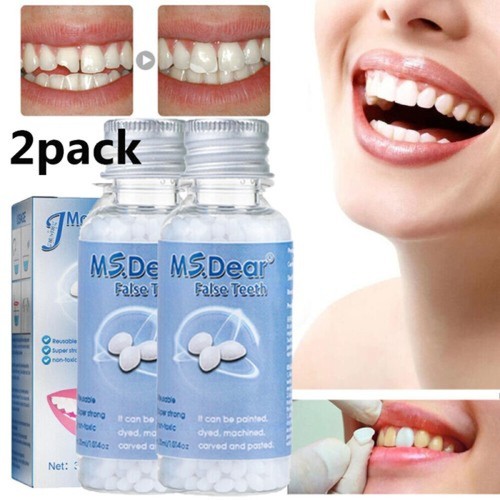 Tooth repair kit - repair,