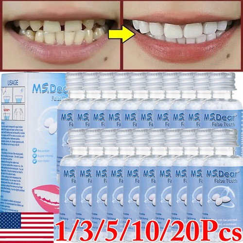 Temporary tooth repair kit - tooth,