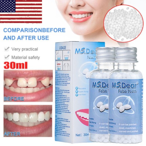 Tooth repair kit - 2x,