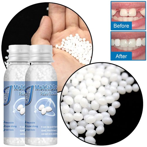Tooth repair kit - 2x,
