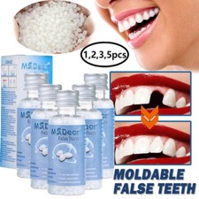 Tooth Repair Kit -Temporary