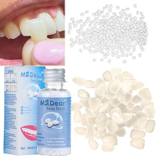 Teeth repair temporary fix kit - teeth,