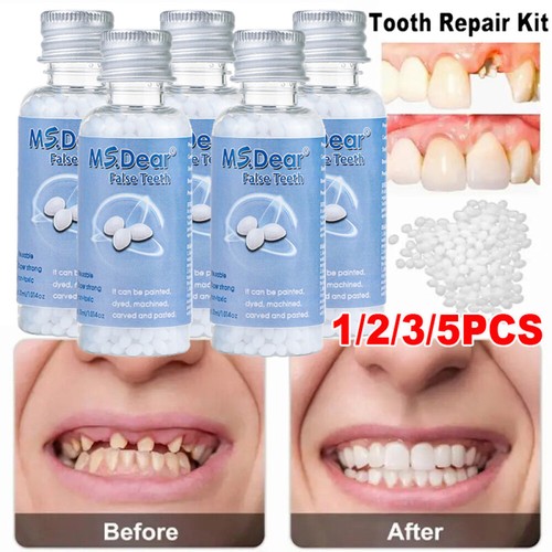 Tooth repair kit temporary - tooth,