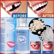 Tooth Repair Kit - Temporary