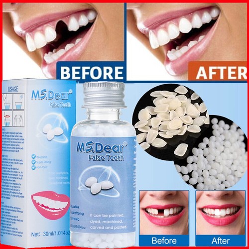 Tooth repair kit temporary - repair,