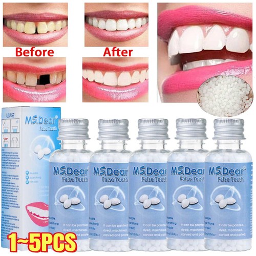 Tooth repair kit temporary - tooth,