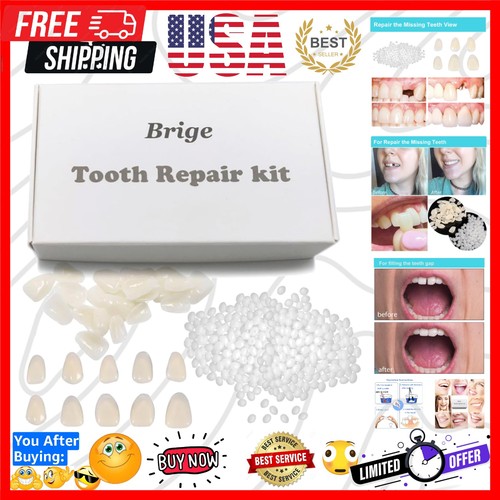 Tooth repair kit for - tooth,
