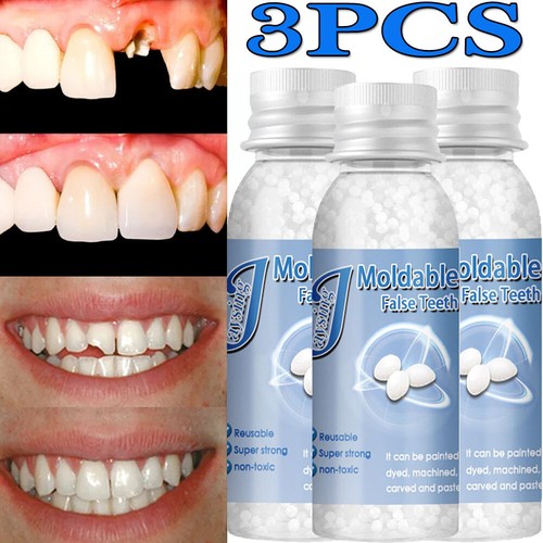 Tooth repair kit - repair,