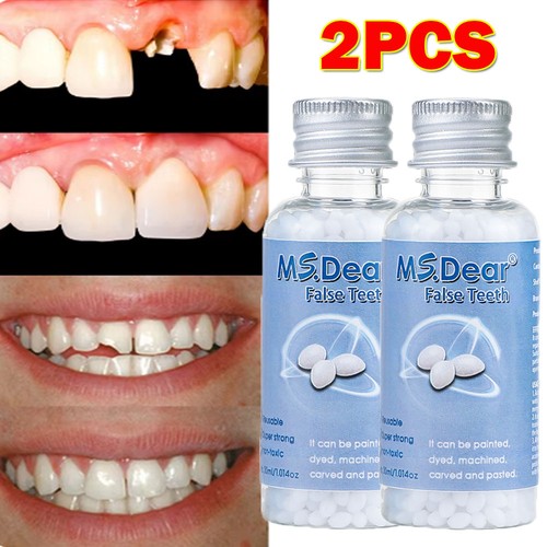 Tooth repair kit - 2x,