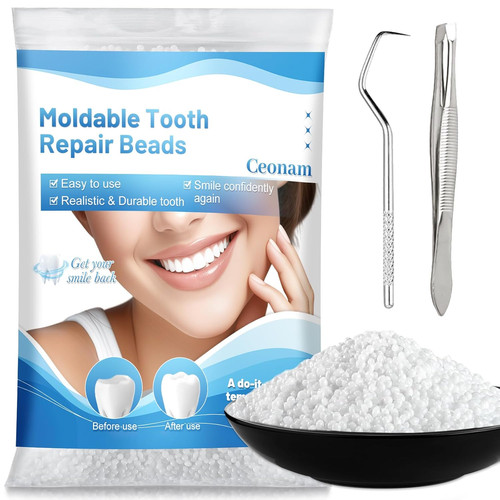 9oz tooth repair beads - tooth,