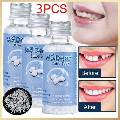 Temporary tooth repair kit - temporary,