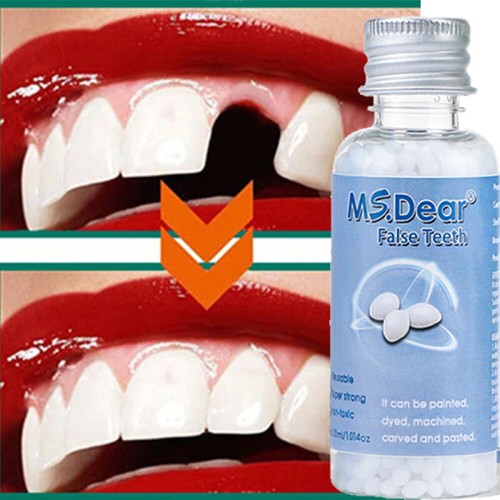 Temporary tooth repair kit - temporary,