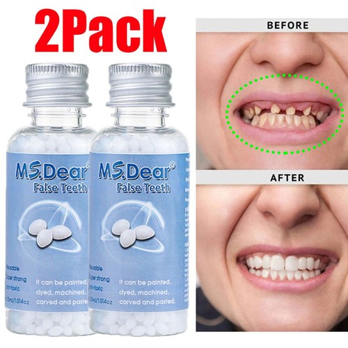 Temporary tooth repair - temporary,