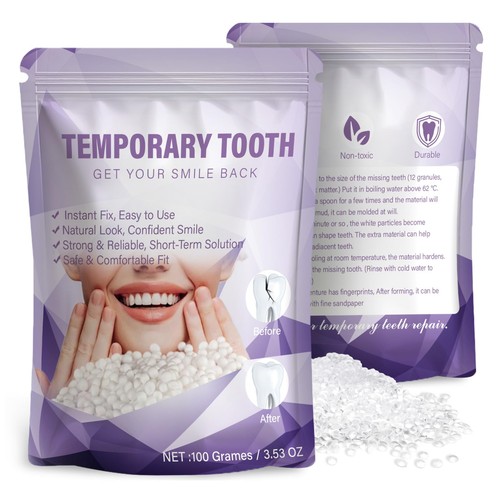 Tooth repair kit moldable - tooth,