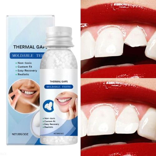 Teeth glue for loose - teeth,