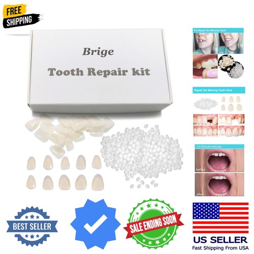 Tooth repair kit for - kit,