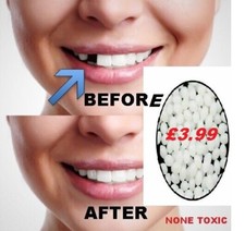 Temporary Tooth Repair Kit Fix