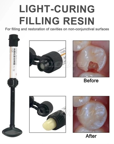 Dental cement teeth - cement,