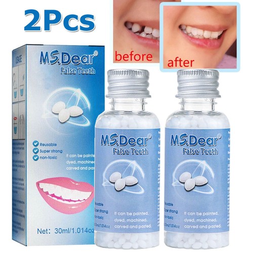 Tooth repair kit - tooth,