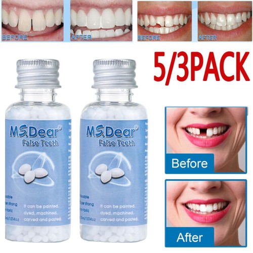 Tooth repair granules - repair,