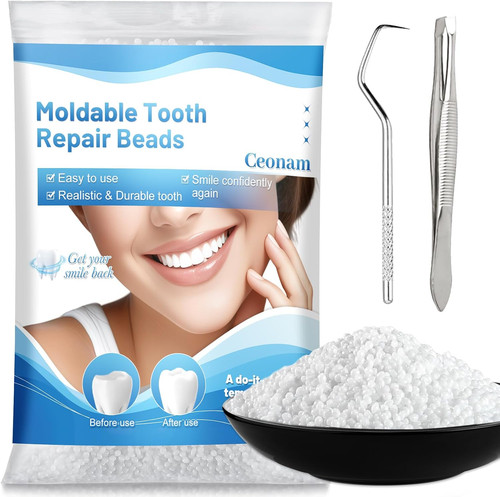 Tooth repair beads - 10.9, kit