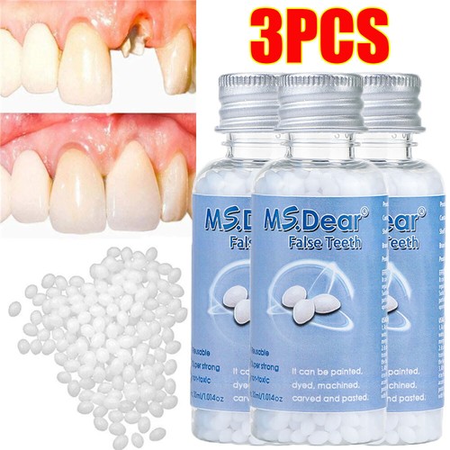 Tooth repair kit - repair,