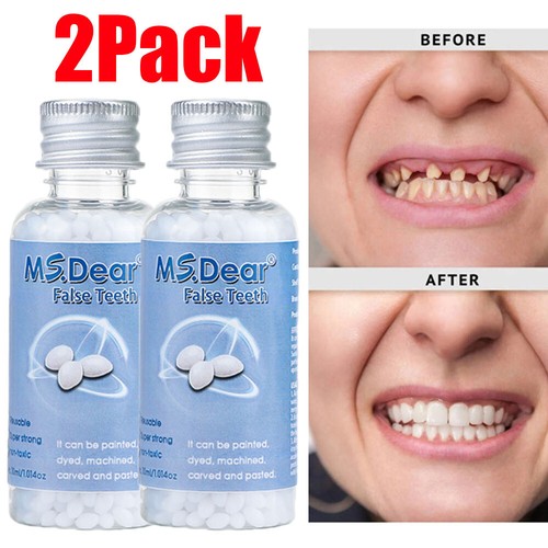 Tooth repair kit - 2x, broken
